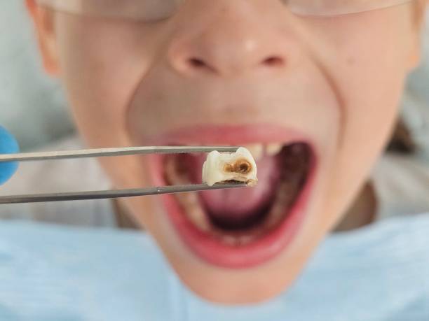 Best Pediatric Emergency Dentist in Highlands, CA